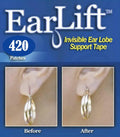 Earring Support Patches 7 Pack A5793